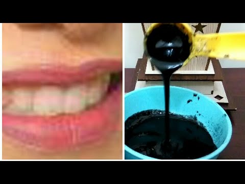 طرق القضاء على إصفرار الأسنان خلال 5 دقائق