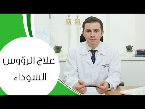 كوستي يقدّم سبل علاج الرؤوس السوداء