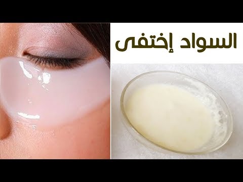 شاهد طريقة سهلة للتخلص من الهالات السوداء