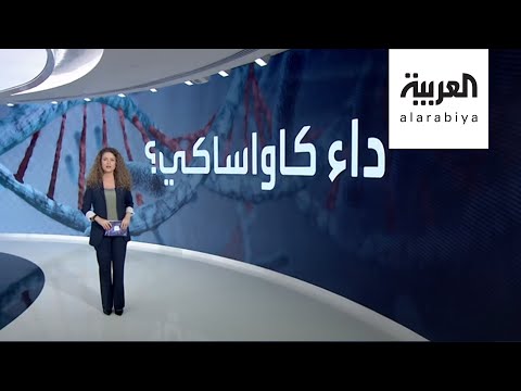 شاهد لماذا عاد مرض كاواساكي ليصيب أطفال العالم بالتزامن مع كورونا